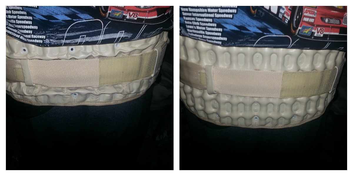 decompression belt before and after decompression belt before and after