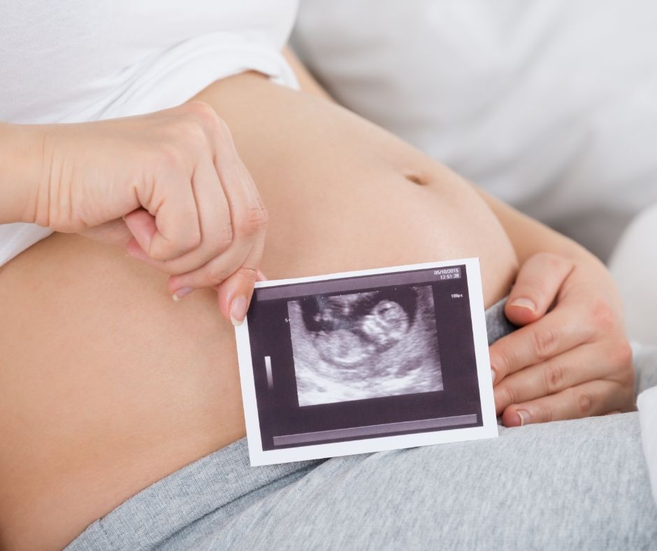 ultrasounds picture