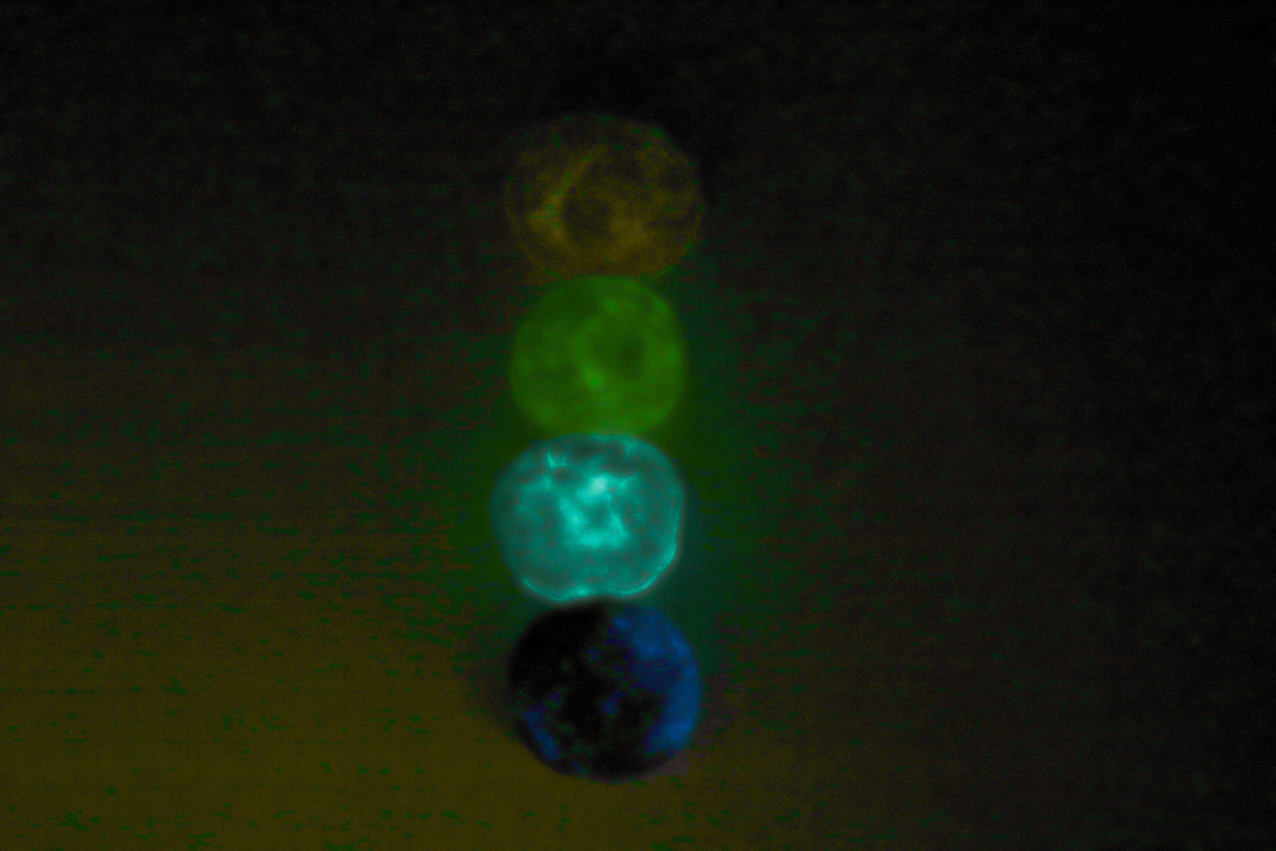 The glow in the dark balls.