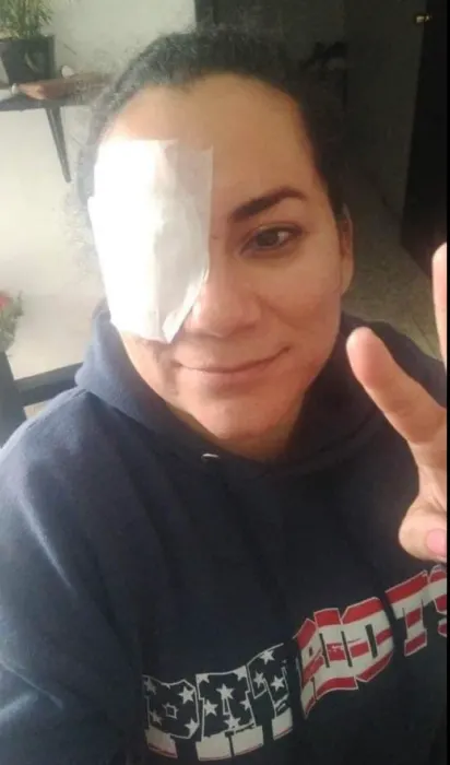 lady with eye covered